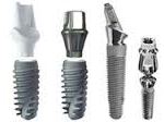 dental implant